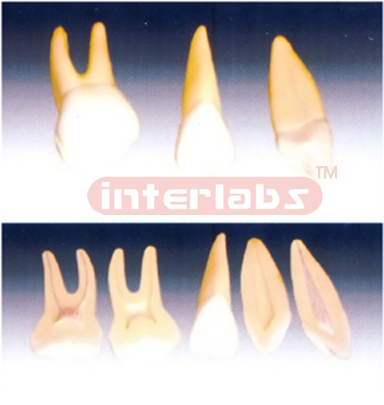 Expansion Model of Human Teeth